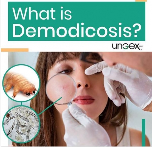 What is Demodicosis?