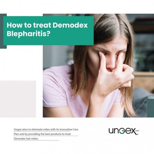 âœ… How to treat Demodex Blepharitis?