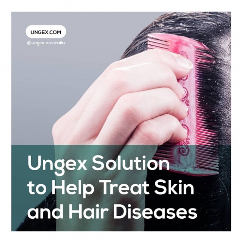 Ungex Solution to Help Treat Skin and Hair Diseases: Eliminate Skin Pests.