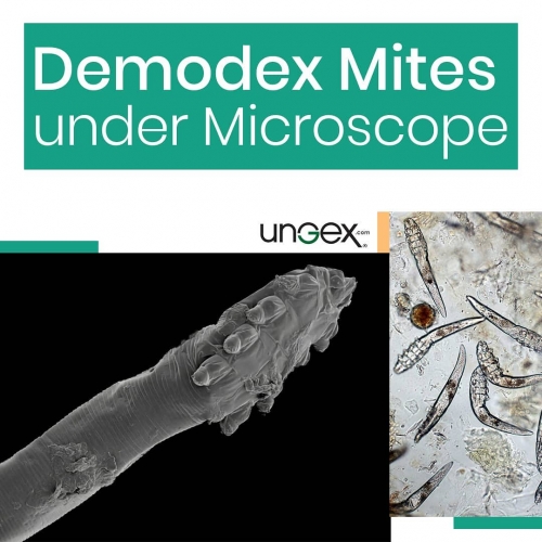 Demodex Mites under Microscope