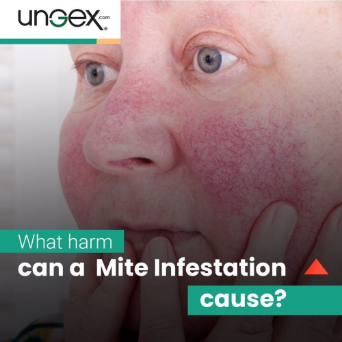 What harm can a mite infestation cause?