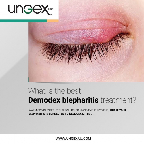 Blepharitis Vs Demodex