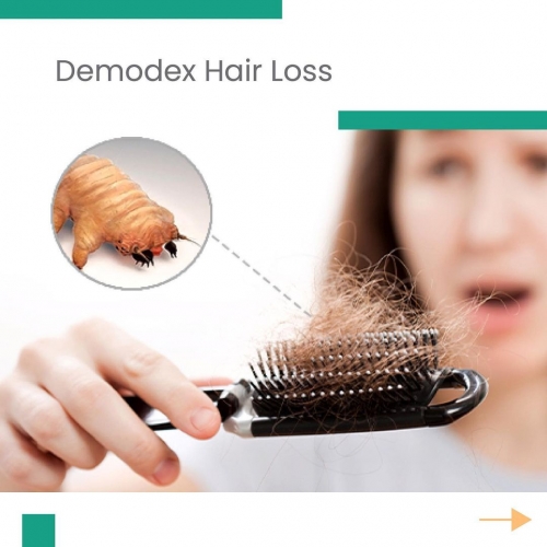 Demodex Hair Loss