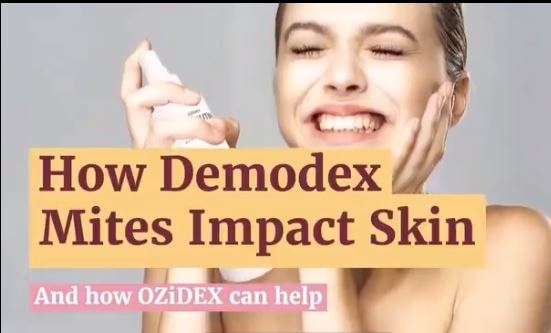How Demodex Mites Impact Skin And how Ozidex can help