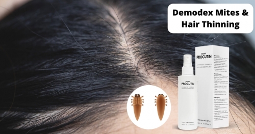 Demodex Mites & Hair Thinning