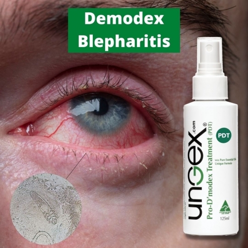 What is the recommended Demodex blepharitis treatment? ðŸ¤¨
