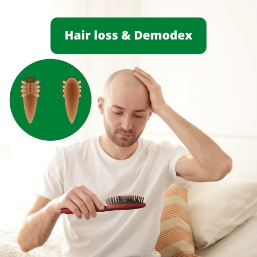 Hair loss & Demodex