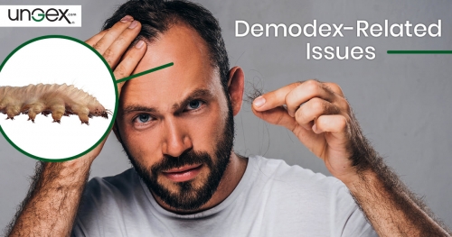 Demodex-Related Issues