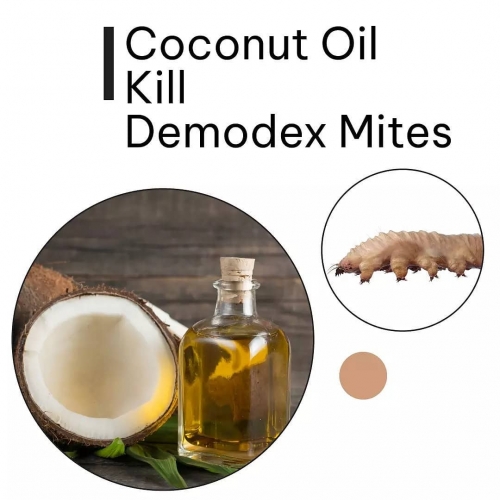 Coconut Oil Kill Demodex Mites