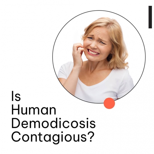 Is Human Demodicosis Contagious?