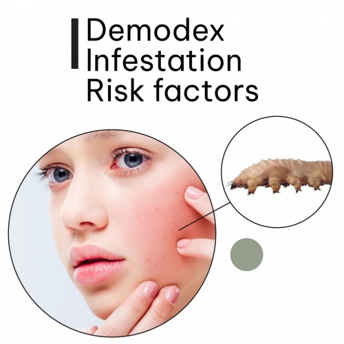 Demodex Infestation Risk factors