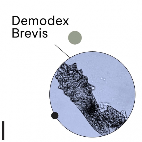 Demodex Brevis