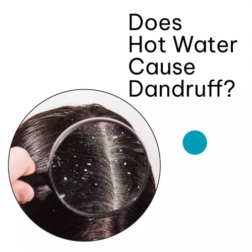 Does Hot Water Cause Dandruff?