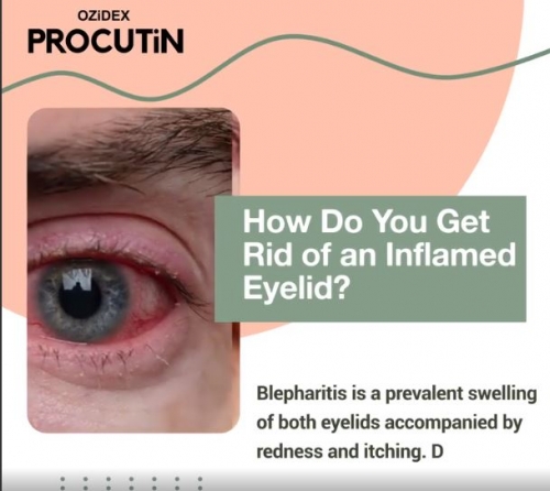 How do you get rid of an inflamed eyelid?