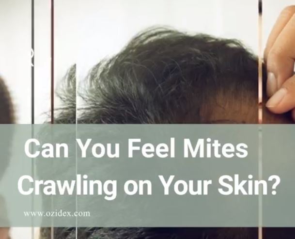 Can you feel mites crawling on your skin?
