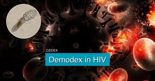 Demodex in HIV