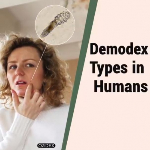 Demodex types in humans