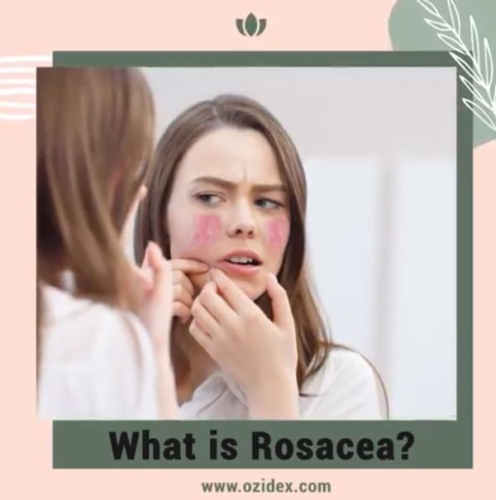 What is Rosacea? ðŸ¤”