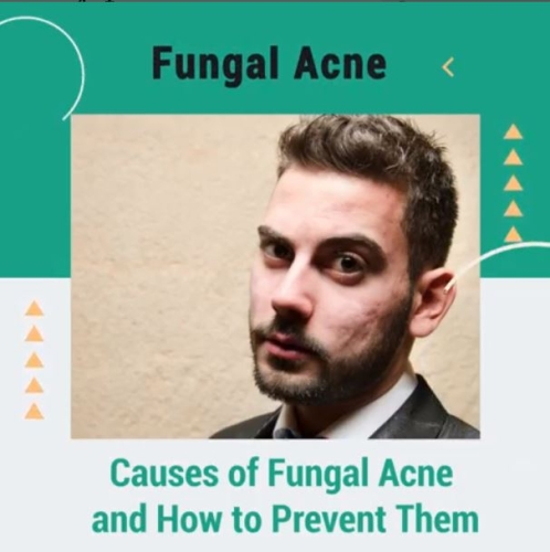 Causes of Fungal Acne and How to Prevent Them ðŸ¤”