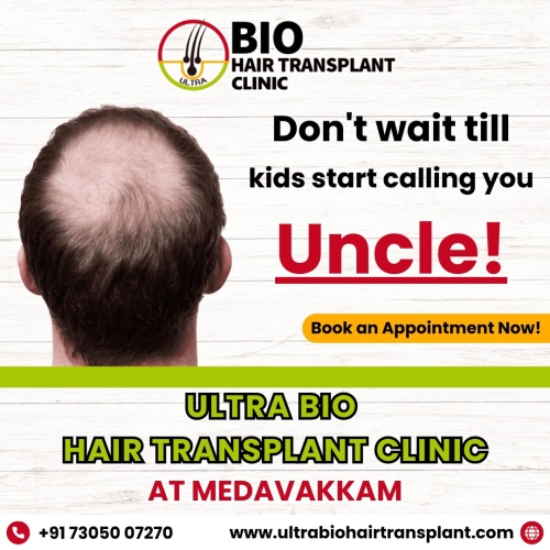 hair transplant clinic chennai