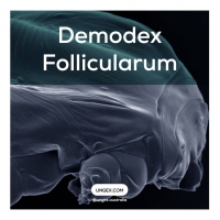 How Do Doctors Treat Demodex Follicularum?