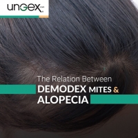 Demodex Vs Alopecia