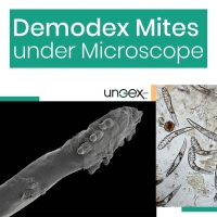 Demodex Mites under Microscope