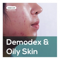 Demodex & Oily Skin