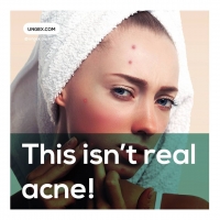THAT ISN'T REALLY ACNE!