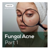 What Is Fungal Acne? PickP