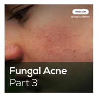 Fungal Acne-Part3