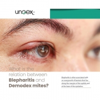 âœ… What is the relation between Blepharitis and Demodex mites?