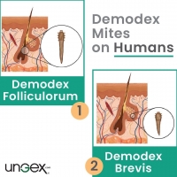 Demodex on humans