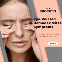 Eye-related Demodex Mites symptoms