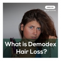 What is Demodex Hair loss?