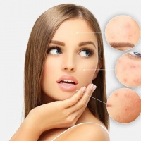Meet Your Skin Pests. ðŸ˜³ PickP