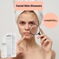Facial Skin Diseases PickP