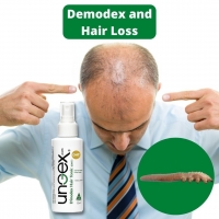 Hair loss and Demodex