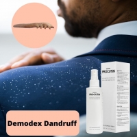 Demodex Dandruff