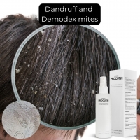 Can dandruff be a sign of mites? 🤔🤔🤔