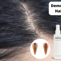 Demodex Mites & Hair Thinning PickP