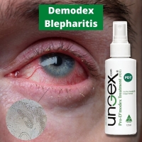 What is the recommended Demodex blepharitis treatment? ðŸ¤¨ PickP
