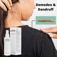 Demodex & Dandruff
