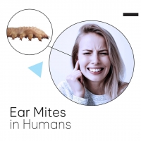 Ear Mites in Humans
