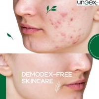 Demodex-Free Skincare PickP