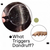 What Triggers Dandruff? PickP