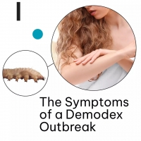 The Symptoms of a Demodex Outbreak