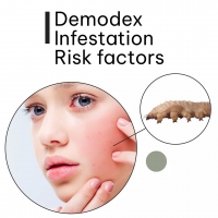 Demodex Infestation Risk factors