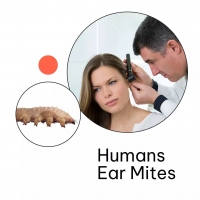 Human Ear Mites