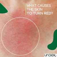 What Causes the Skin to Turn Red?